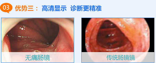 优势3 诊断精准
